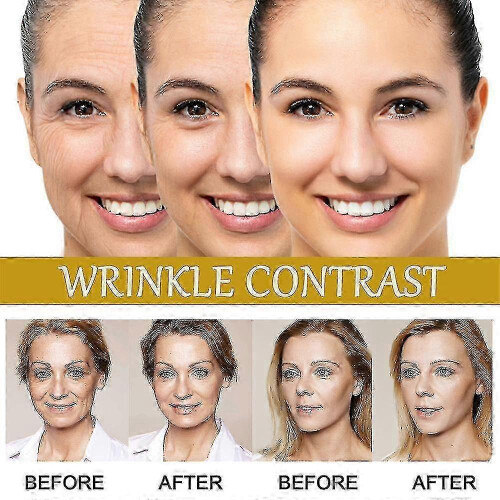 3x Advanced Bee-venom Serum Anti-aging Moisturizer for Face And Neck-- 2