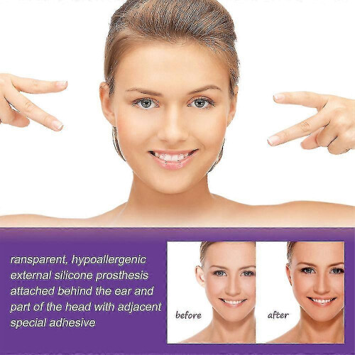 6pcs Ear Corrector Tape Ear Fixer Cosmetic Ear Stickers 2