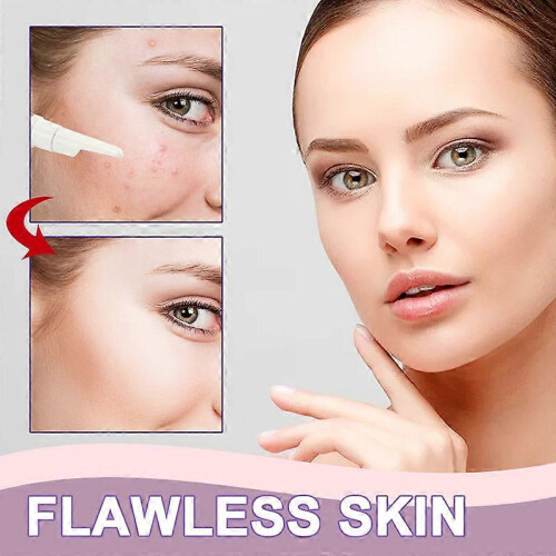 3Pcs Skinnery Crème pour l'élimination des taches de rousseur 2