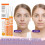 3Pcs Skinnery Crème pour l'élimination des taches de rousseur 7