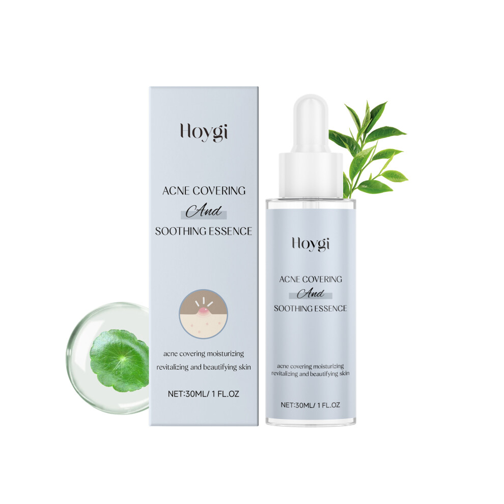 Hoygi Beruhigendes Anti-Akne-Serum – Reinigt Die Poren GrüNdlich Und Entfernt Akneflecken, 30 Ml-image