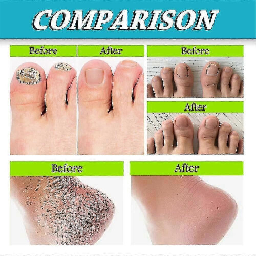 Ouhoe 2Pcs Deodorant Foot Spray 30ml |  | 2