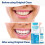 EverSmile AlignerFresh Καθαριστικό - Αφρός Καθαρισμού για Invisalign, ClearCorrect, Essix, Hawley 4