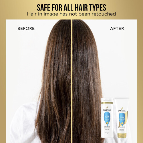 Pantene Pantene Σαμπουάν Δίδυμο με Θεραπεία Μαλλιών, Κλασικό Καθαρισμό, 55.9 fl oz 1