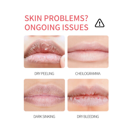 Moisturizing Lip Balm - Pack of 4 1