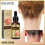 3x Huile Essentielle Psoriasis 2