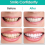 Snap On False Teeth Upper + Lower Dental Instant Veneers Dentures Tooth Cover 5