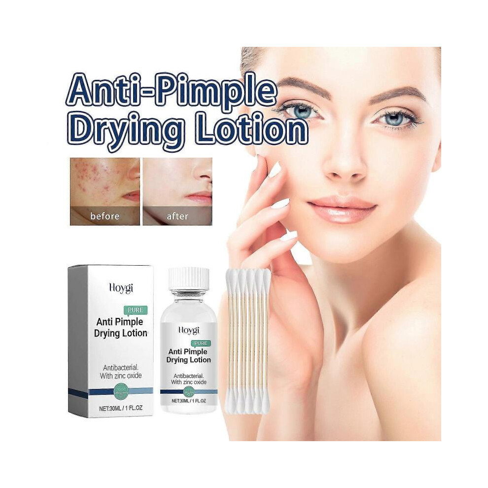 Anti-Pimple Drying Lotion, Spot Treatment with Zinc Oxide, AHA Lotion for Drying Pimples, Acne Spot Treatment Dries Out Pimples
