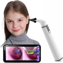 Draadloze otoscoop-oorcamera met dubbele weergave, 3,9 mm 720phd wifi-oorcamera met 6 led-lampjes voor kinderen en volwassenen, voor Android en iPhone