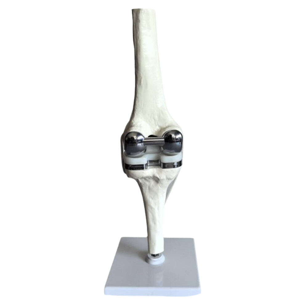 Knee Joint Model Simulation Replacement