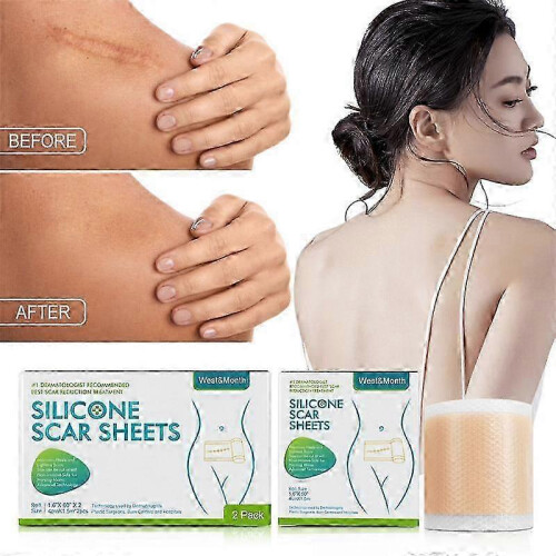 4*150cm Self-Adhesive Scar Patch Silicone Scar Removal Patch for Acne Trauma 2