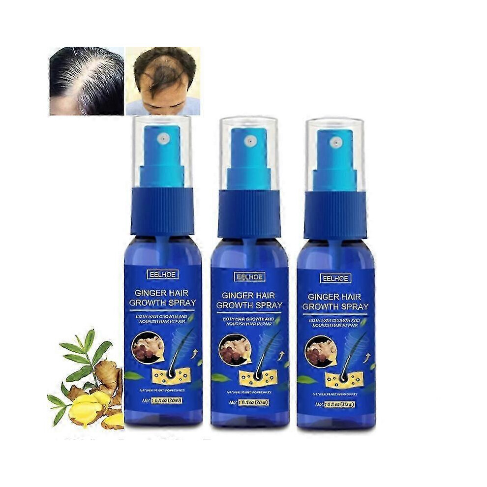Green 3Pcs Hair Regrowth Spray, Ginger Natural Ingredients Thickening Hair Spray, Repairs Hair Growth Serum, Nourishing Hair Growth Care, Repair Hair