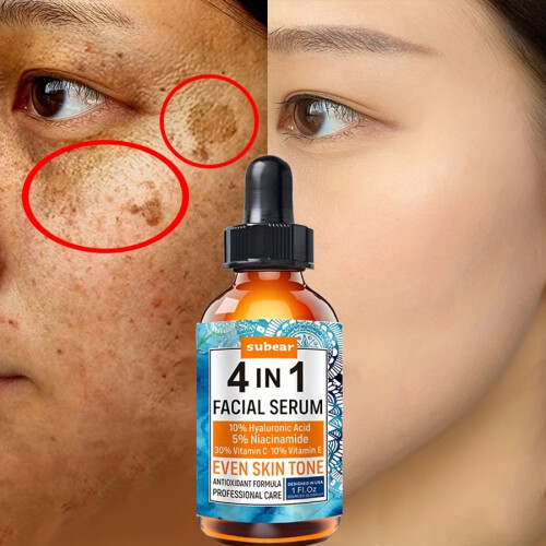 30ml Vitamin C Serum for Face-Anti Aging Face Serum 2