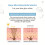 30ml Vitamin C Serum for Face-Anti Aging Face Serum 4