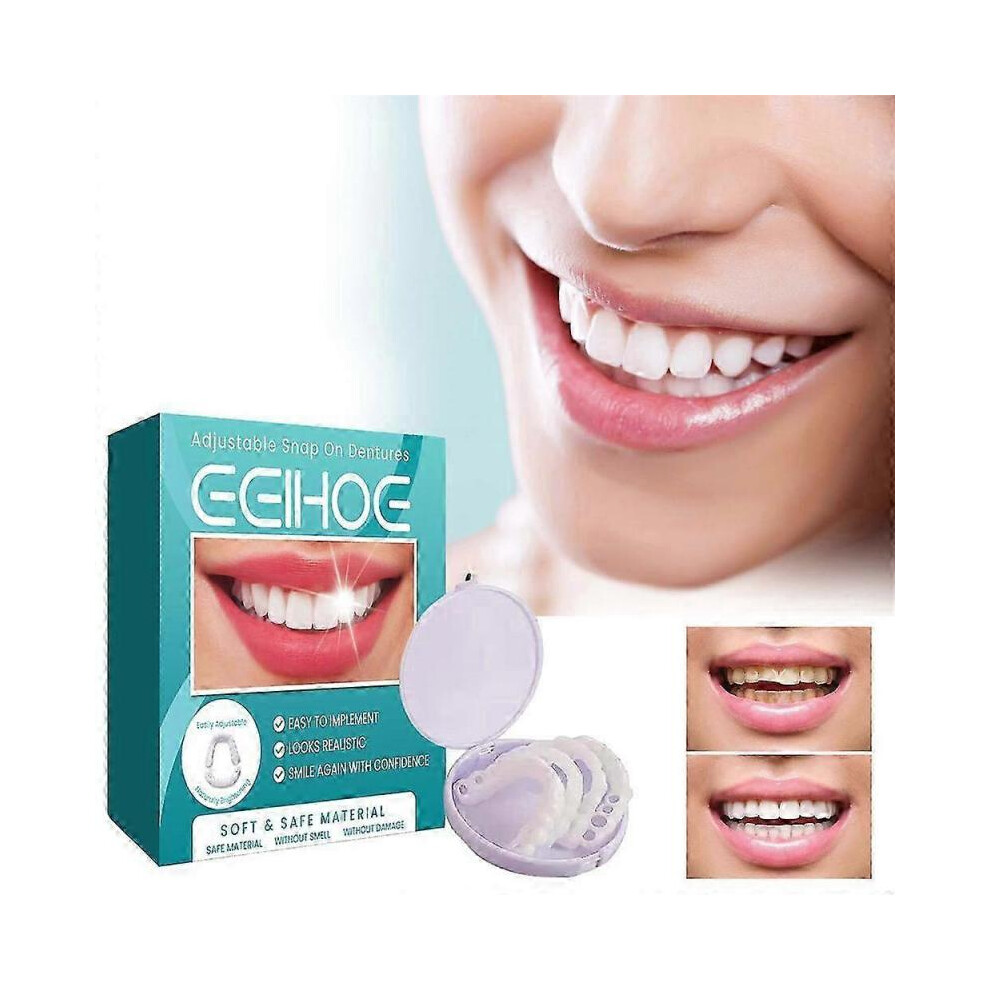 (1pair) Adjustable Snap-on Dentures, Veneers Denture Braces Plus Denture Cases, Temporary Fillings Braces Interdental Fillings Straightening Dentures