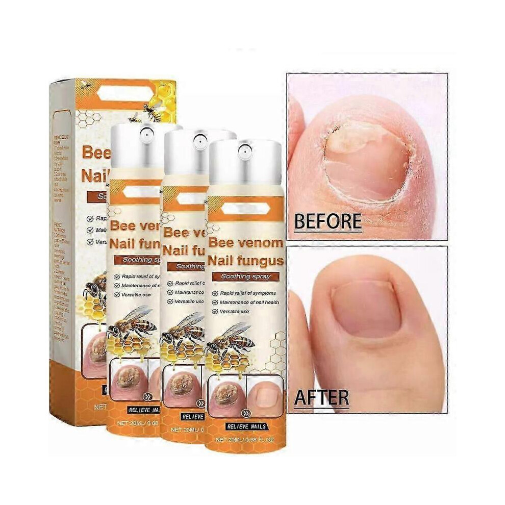 (3pcs) Bee Venom nail Care Spray, Hand, foot and Nail Cleaning spray, Moisturizing nail spray