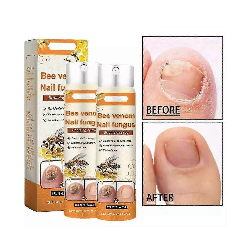 (2pcs) Bee Venom nail Care Spray, Hand, foot and Nail Cleaning spray, Moisturizing nail spray