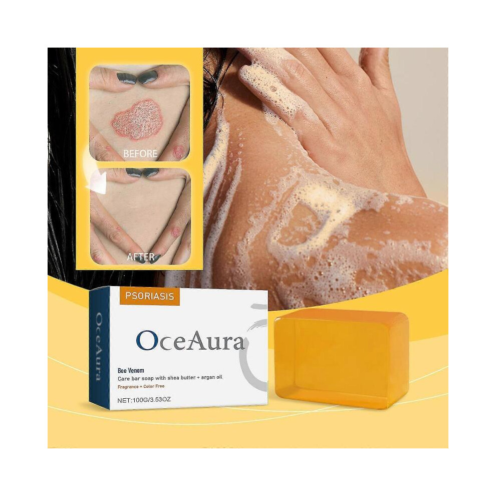 Bee Venom Psoriasis Treatment Soap, Bee Venom Psoriasis Care Bar Soap, Bee Venom Care Bar Soap with Shea Butter & Argan Oil