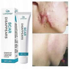 Crème pour l'élimination des cicatrices Gel de réparation Pommade de soin