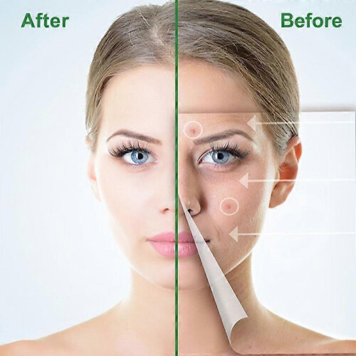 50PCS Beauty Acne tools Hydrocolloid Acne Patch Set Skin Tag Remover Pimple Master Hydrocolloid Patch 2