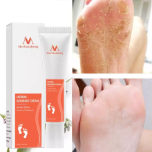 Foot Anti-Inflammatory Cream Anti-Fungal Infection Removal Feet Callus Dead-Skin