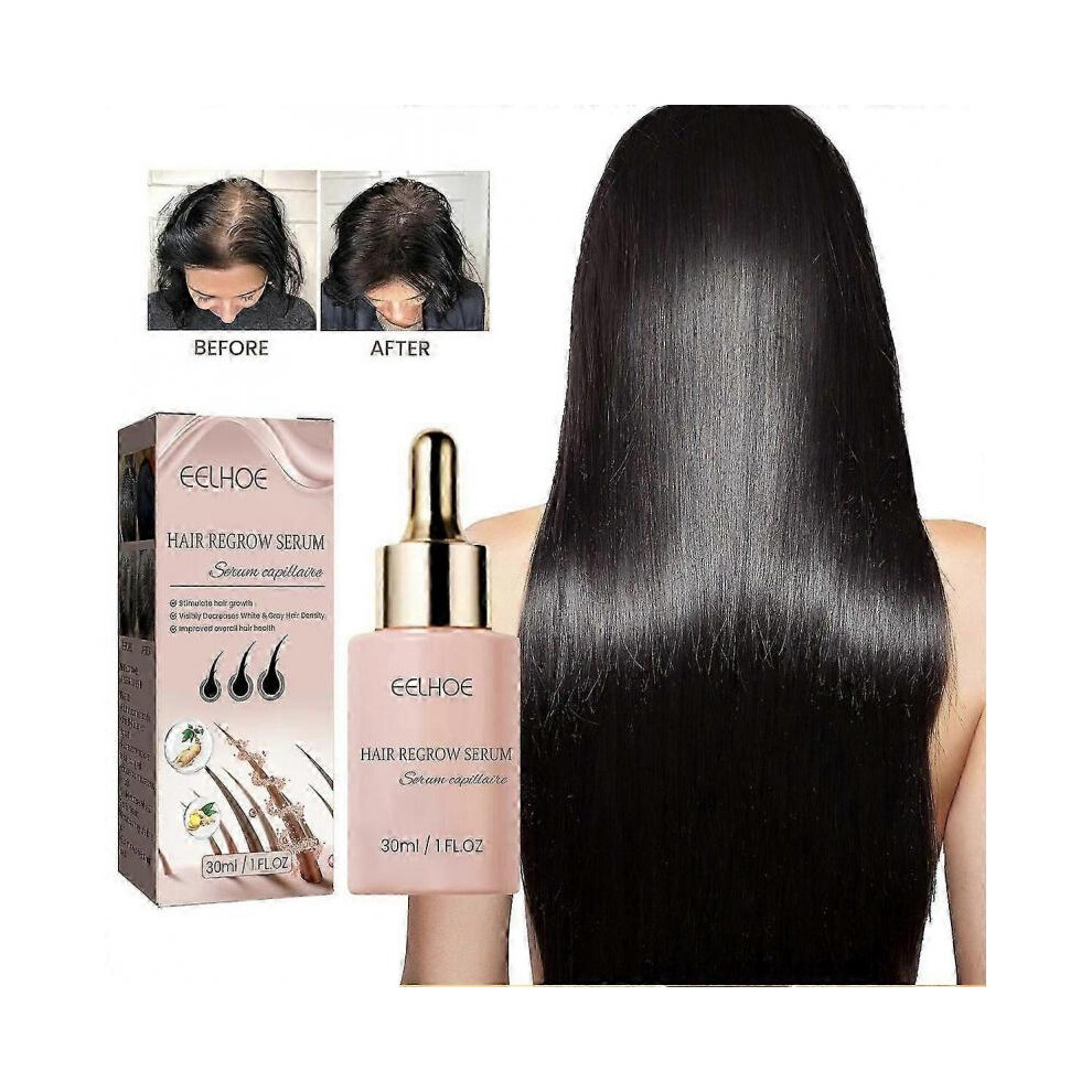 (1Pcs) 30ml Hair Growth Serum For Thicker Fuller Healthier Hair, Reduces Breakage and Shedding 1Pcs
