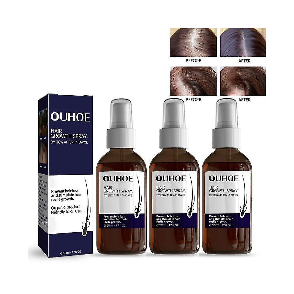 3x Hair Growth Germinal Oil Regrow Germinal Serum for Nourishing Hair Roots 50ml