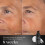 Medik8 Medik8 Liquid Peptides Advanced MP - With Breakthrough Bio-Technology, Dual MiniProteins - 30% Multi-Peptide Complex - 30ml 3