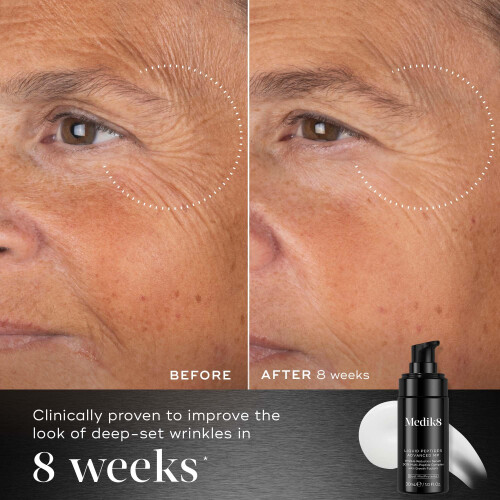 Medik8 Medik8 Liquid Peptides Advanced MP - With Breakthrough Bio-Technology, Dual MiniProteins - 30% Multi-Peptide Complex - 30ml 2