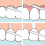 Tepe Fil dentaire TePe pour ponts et implants dentaires, 30 pi   ces 4