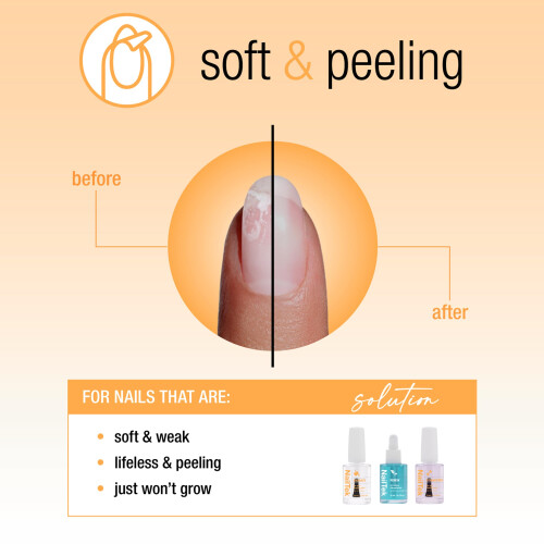 NailTek herstelkit 1
