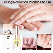 (1pcs) Peeling Nail Therapy Vitamin E Serum, Vitamin E Nail and Cuticle Oil, Nail Cuticle Oil Vitamin E, Cuticle Oil for Nails, Nourish Dry Damaged Nails