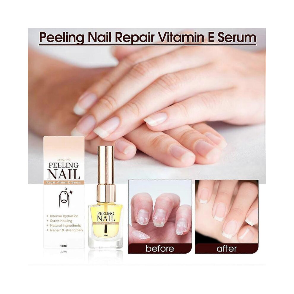 (1pcs) Peeling Nail Therapy Vitamin E Serum, Vitamin E Nail and Cuticle Oil, Nail Cuticle Oil Vitamin E, Cuticle Oil for Nails, Nourish Dry Damaged Na