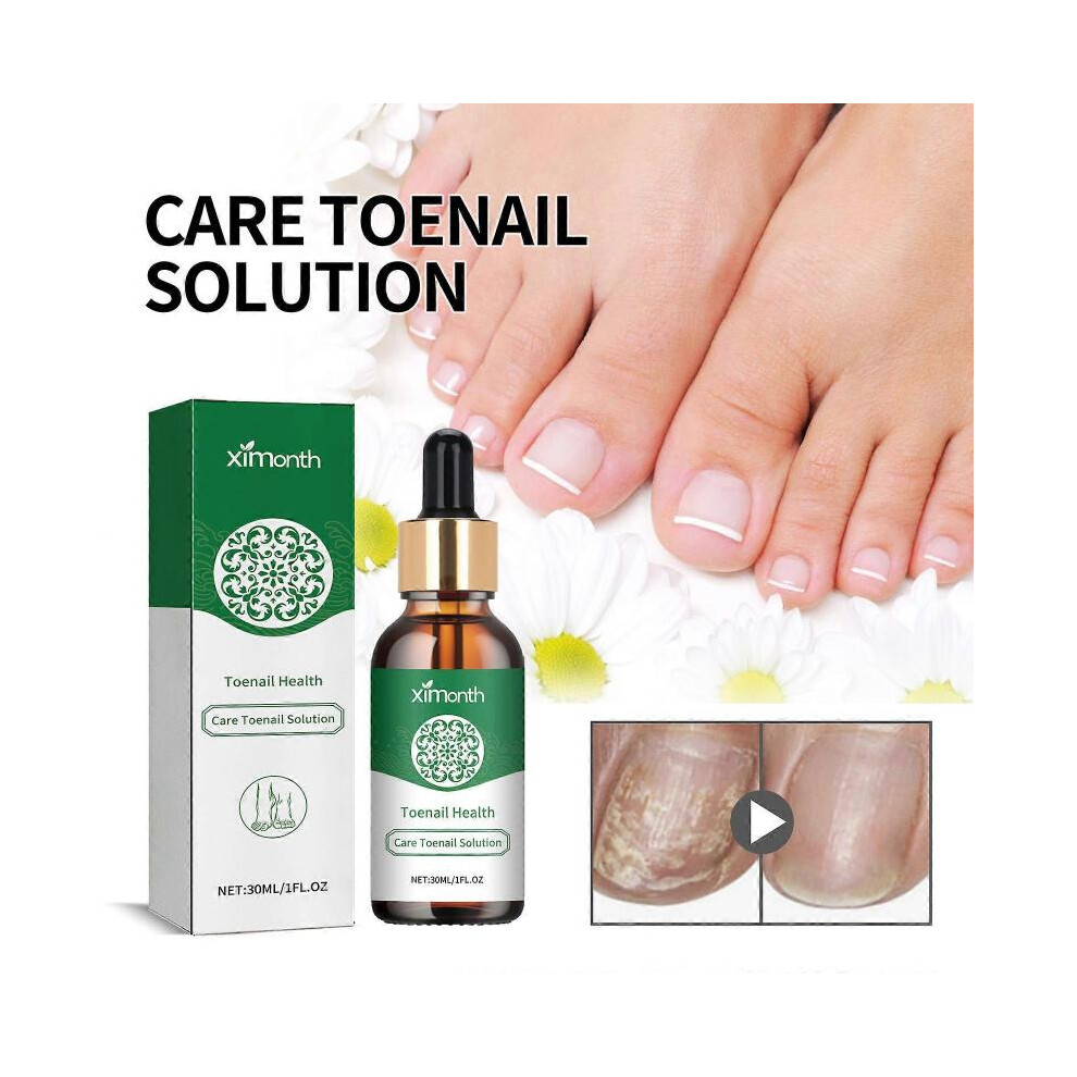 (1pcs) 30ml Toenail Treatment Oil, Natural Toenail Oil for Nails, Toenail Nail Treatment for Repairing Damaged and Discolored Nails