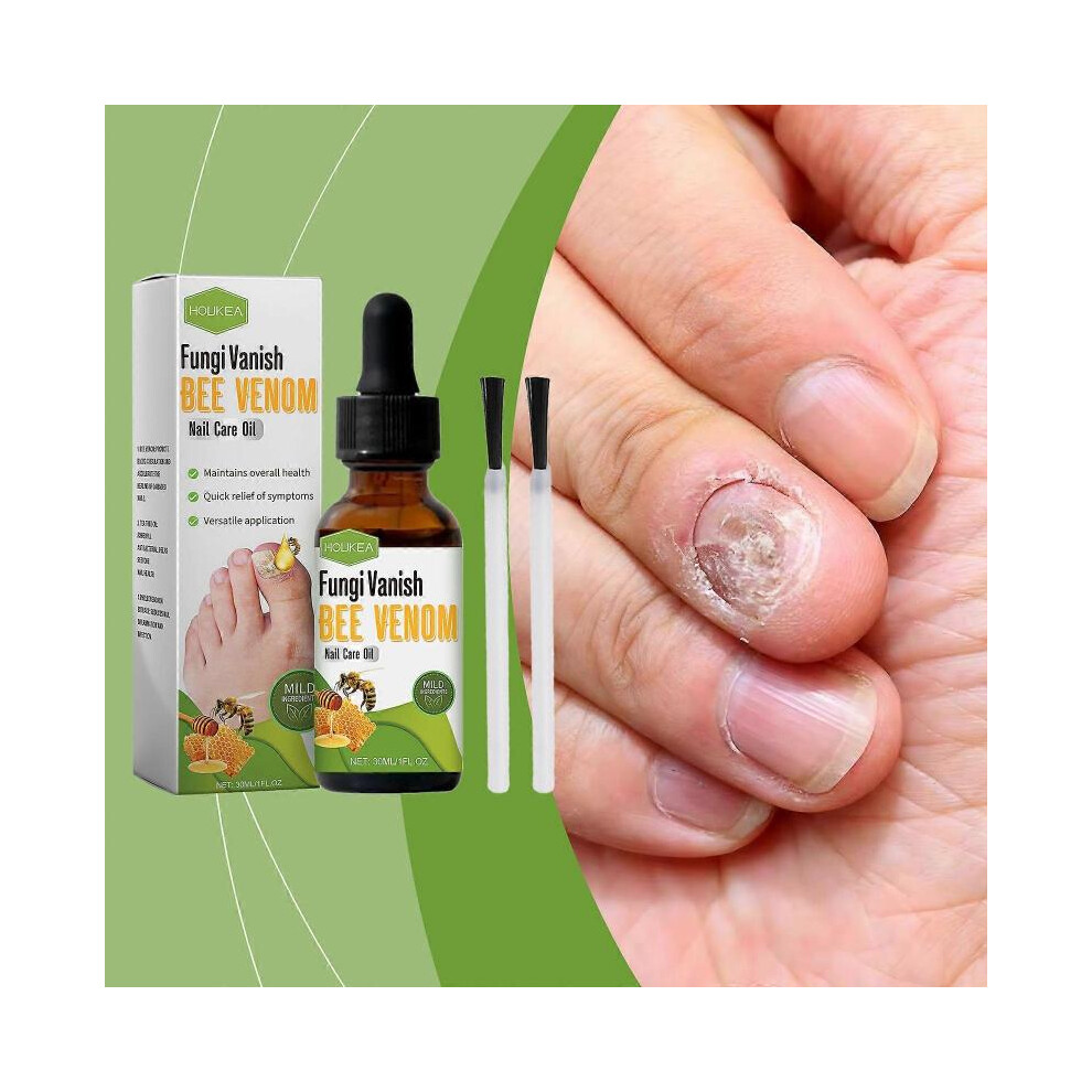 (2pcs) Nail Growth and Repair Serum, Extra Strength Nail Repair Solution, Bee Venom Nail Care Oil for Thin Nail, Brittle & Damaged-image-OPC-PH5QF7R-NEW