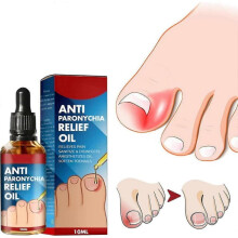 Anti Paronychia Relief Oil, Anti-paronychia Auxiliary Oil, Ingrown Toenail Correction, Nail Care Oils for Ingrown Toenails