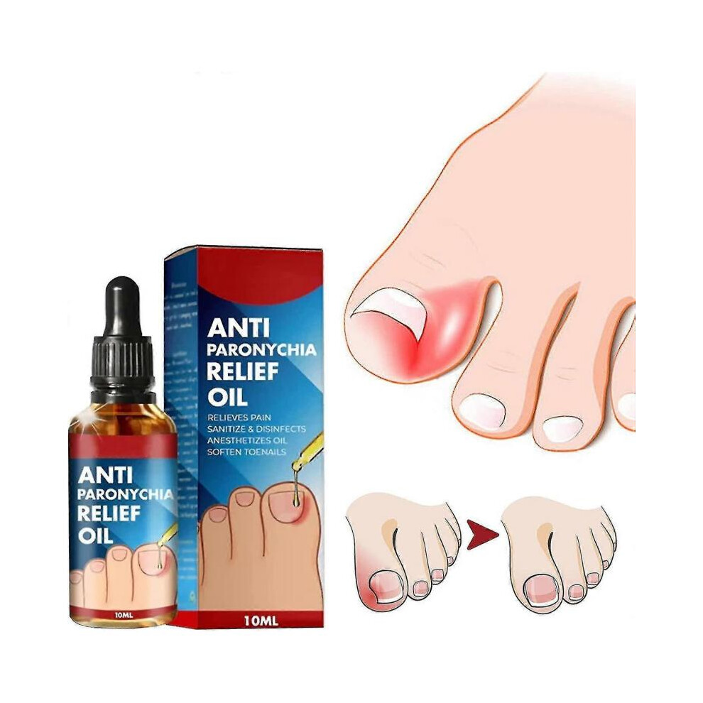 Anti Paronychia Relief Oil, Anti-paronychia Auxiliary Oil, Ingrown Toenail Correction, Nail Care Oils for Ingrown Toenails