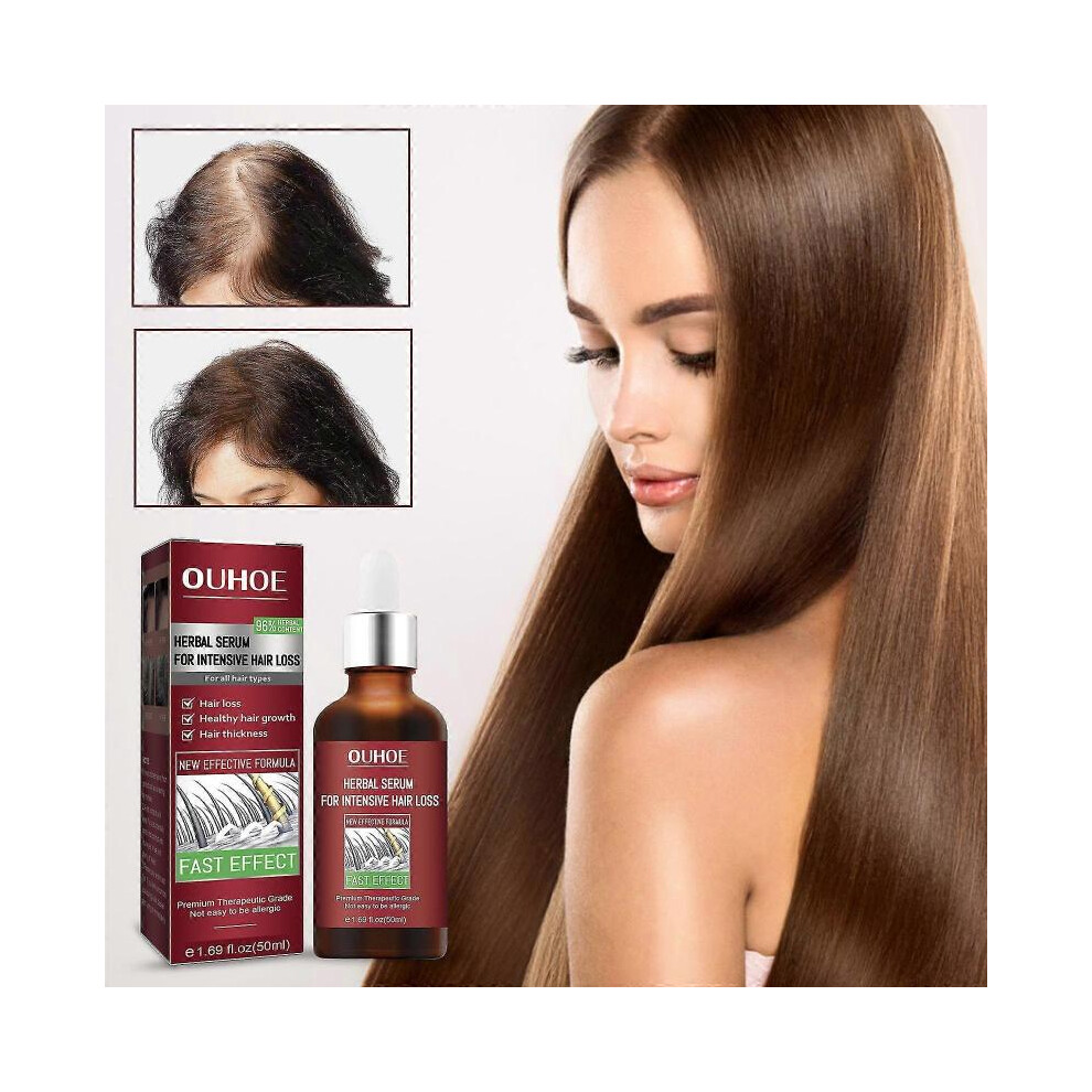 50ml anti-hair loss essence essential oil thick hair growth essence hair care anti-baldness anti-hair loss essence