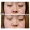 Dermaflage Scar Filler Refill  4 Applicators 5