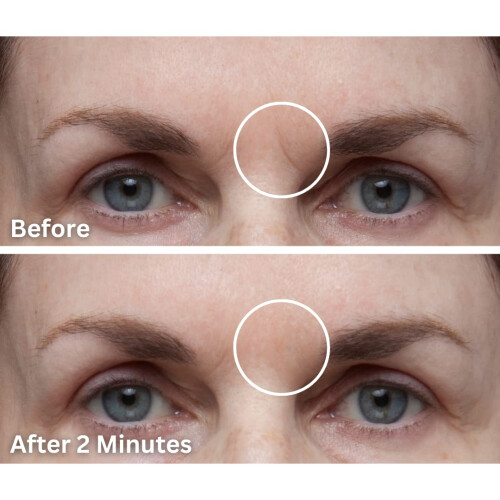 Dermaflage Scar Filler Refill  4 Applicators 2