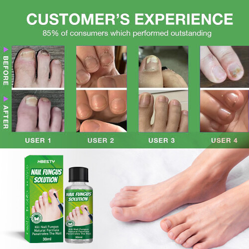 Herbal Ash Armor Liquid Ash Armor Clear And Bright Ash Plant Extract Foot Care Solution 2