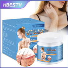 White Spot Cleansing Cream For Adults With White Spots In Their Hands And Feet