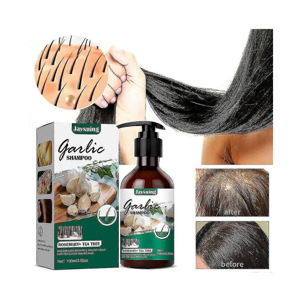 100ml Garlic Shampoo Clean Itching Anti-dandruff Shampoo Hair Growth Nourishing Shampoo