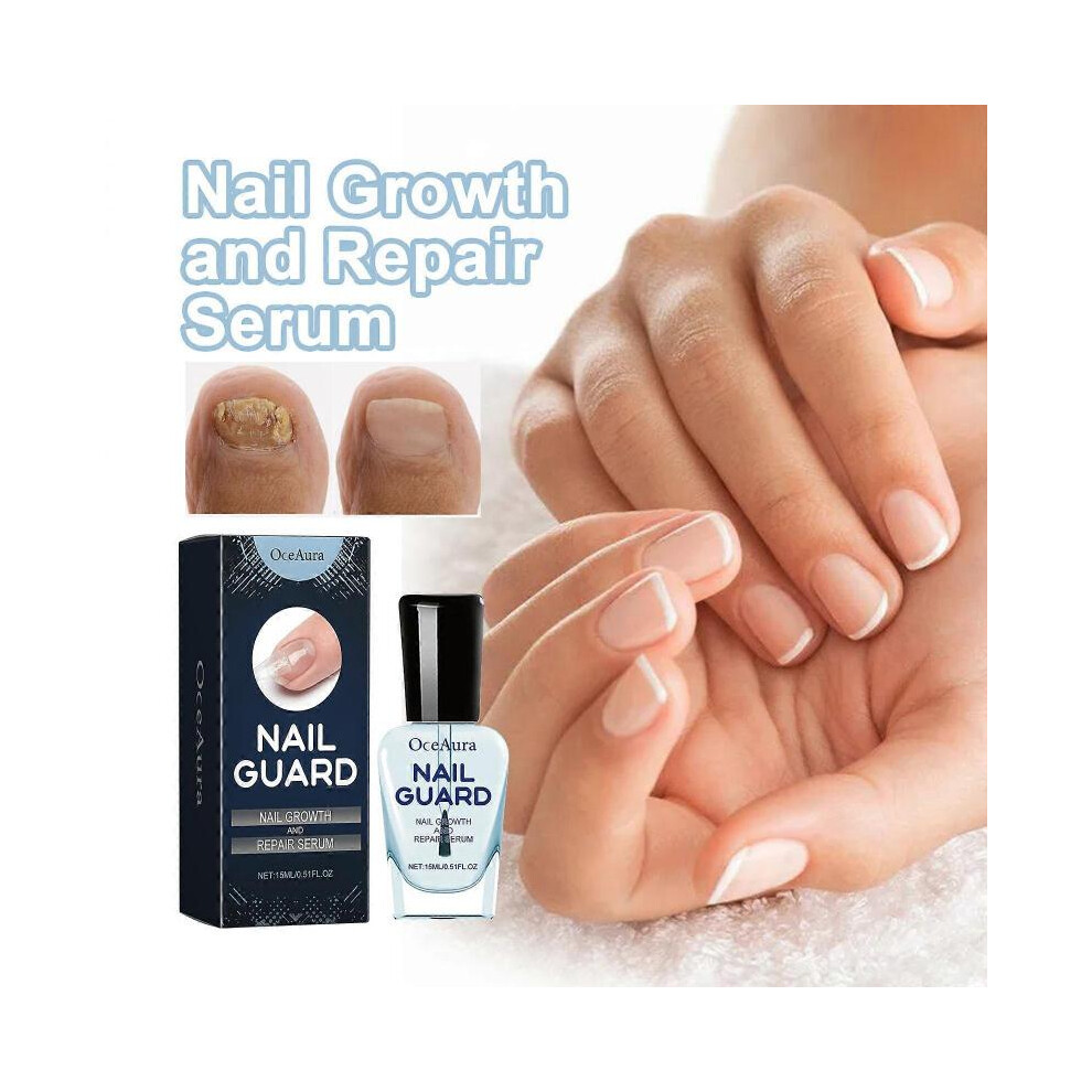 (2pcs - 30ml) Nail Growth and Repair Serum, Nail Cuticle Oil Nail Care Strengthener Treatment Serum Helps Repair Brittle & Damaged Nails