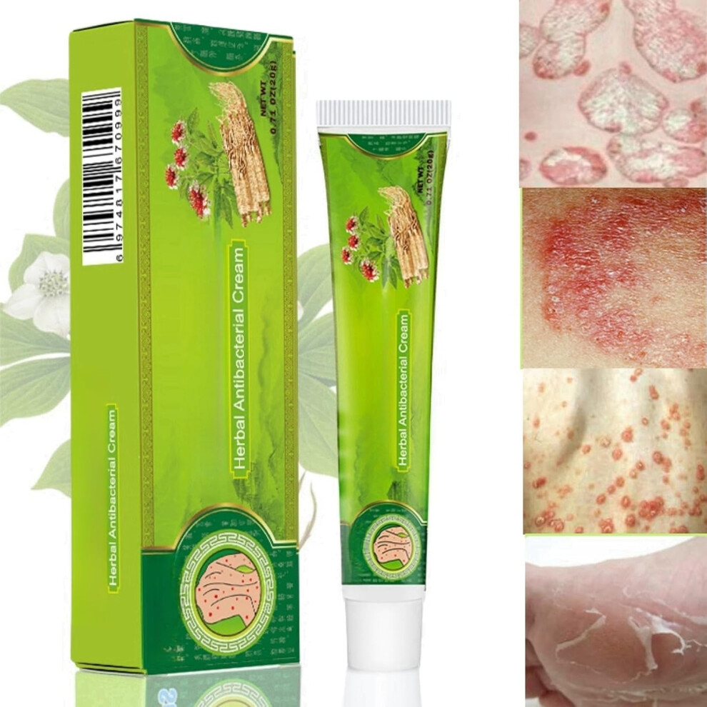 Gogerstar Cream Anti-Itch ,Chinese Herbal ,Skin Moisturizing Soothing Ointment, Anti Chafing ,Natural Face For Dry Skin, For Itchy Skin