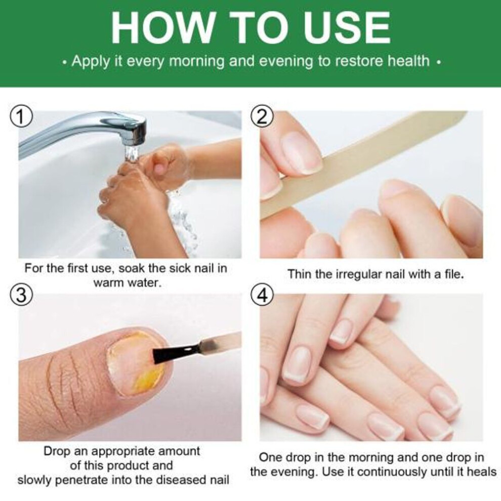 30ML Universal Nail Care Lotion Convenient Safe Antibacterial Foot Solution