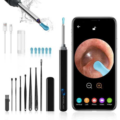 Camera Ear Wax Remover，Black Otoscope Pick for iOS/Android