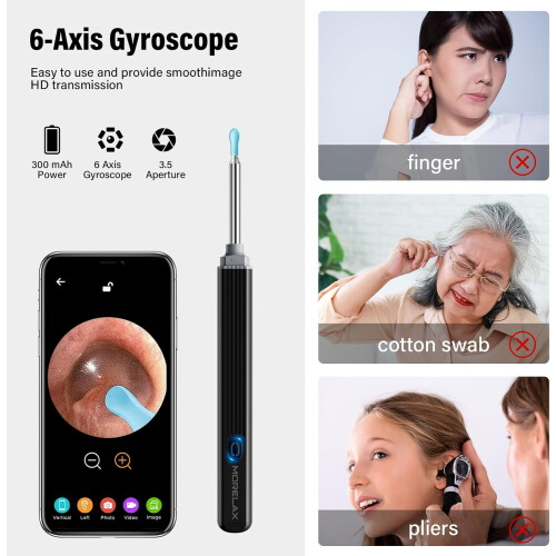 Camera Ear Wax Remover，Black Otoscope Pick for iOS/Android 1