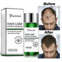 Putimi Natural Hair Growing Serum Restoration Essence Thicken Oil Care 0.67fl Oz