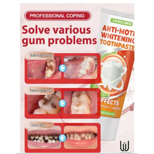 Tooth decay killer, see the change in just 7 days 2